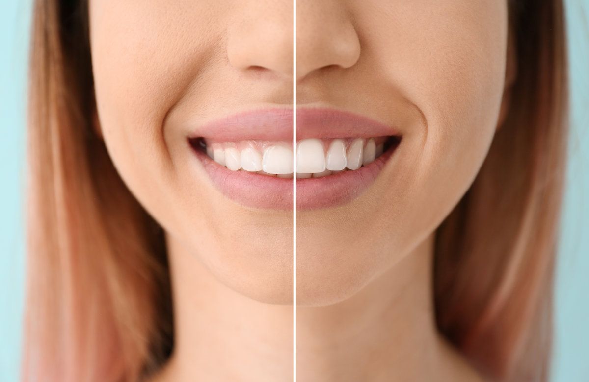 Half smiling face with healthy teeth